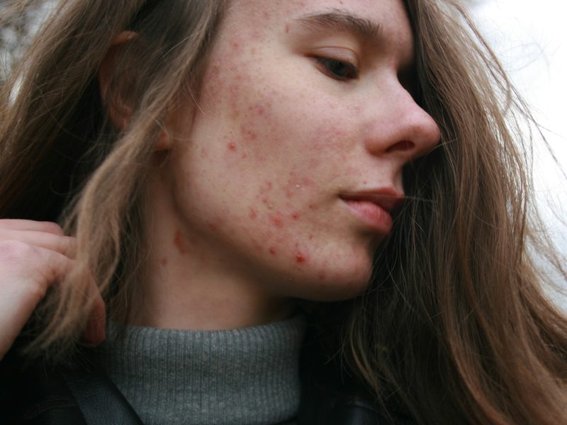 skin problem